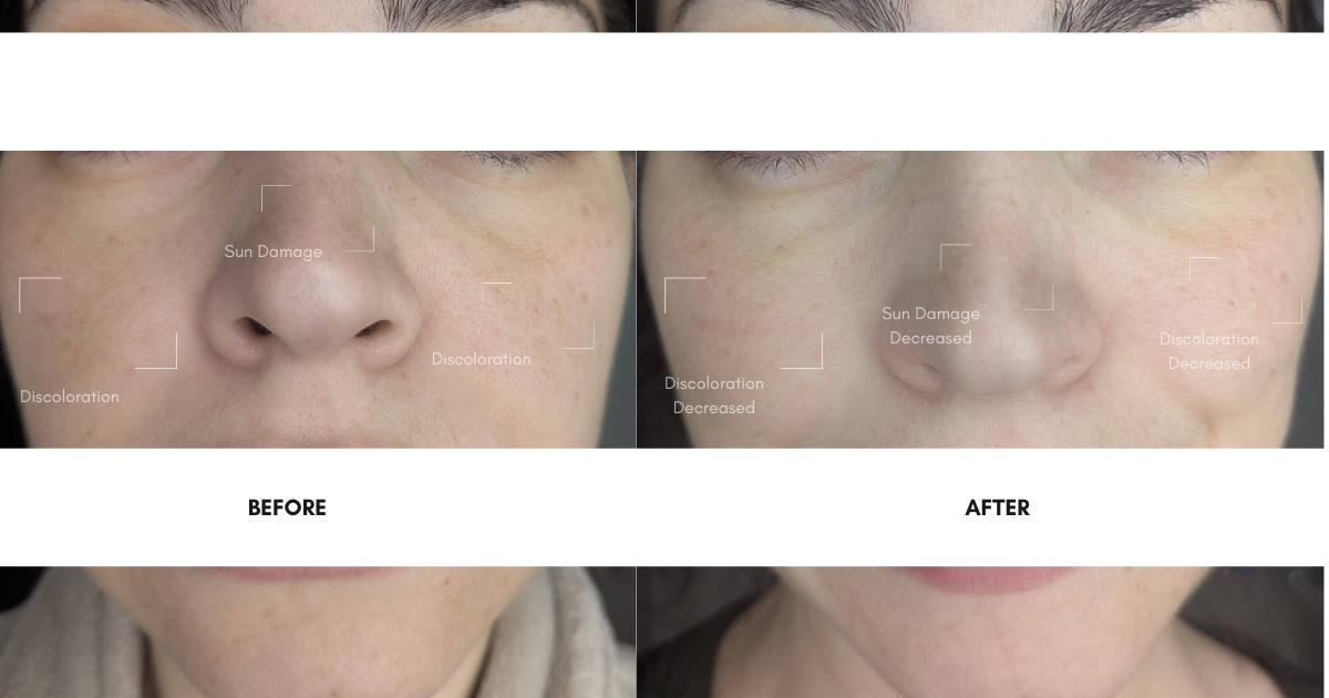 HEIRLOOM - 20% VITAMIN C SERUM - PHYTOSKIN